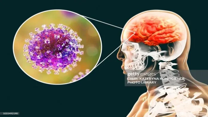 Nipah Virus Schools Colleges leave